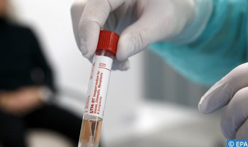 Covid-19: Paris apportera 500 M€ à la recherche internationale de vaccins et de traitements